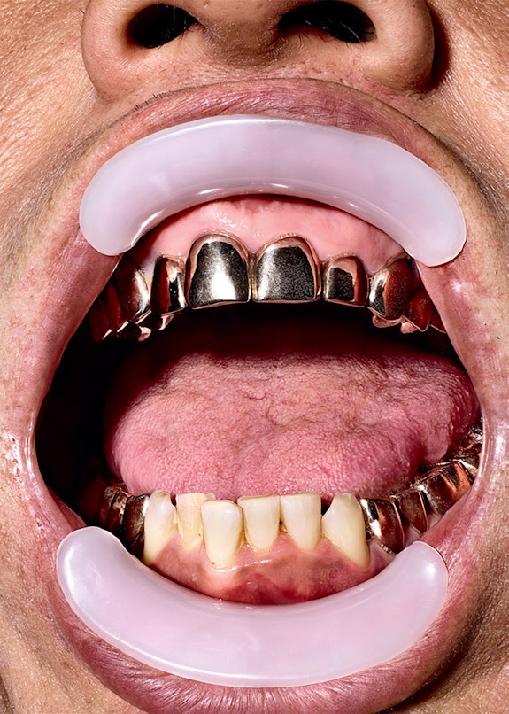 Lance De Los Reyes’s “Gold Teeth Project” for <em>Office Magazine</em>, Spring/Summer 2020. Photo: Richard Burbridge.