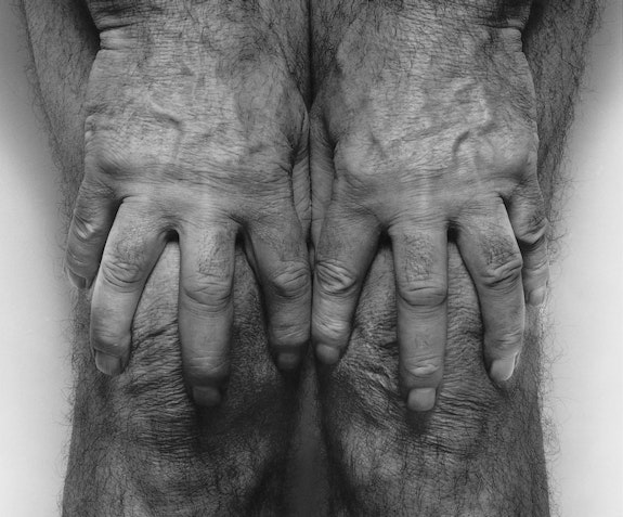 John Coplans, <em>Hands spread on knees</em>, 1985. Gelatin Silver Print. © The John Coplans Trust.