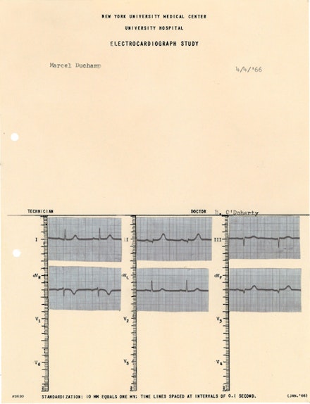 Brian O'Doherty, <em>Portrait of Marcel Duchamp, Mounted cardiogram</em>, <em>4/4/66</em>, 1966. Ink and typewritten text on paper, 11 x 8 1/2 inches.